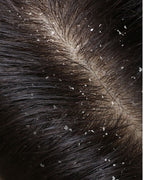 Hair Care Gift Set For Irritated Scalp